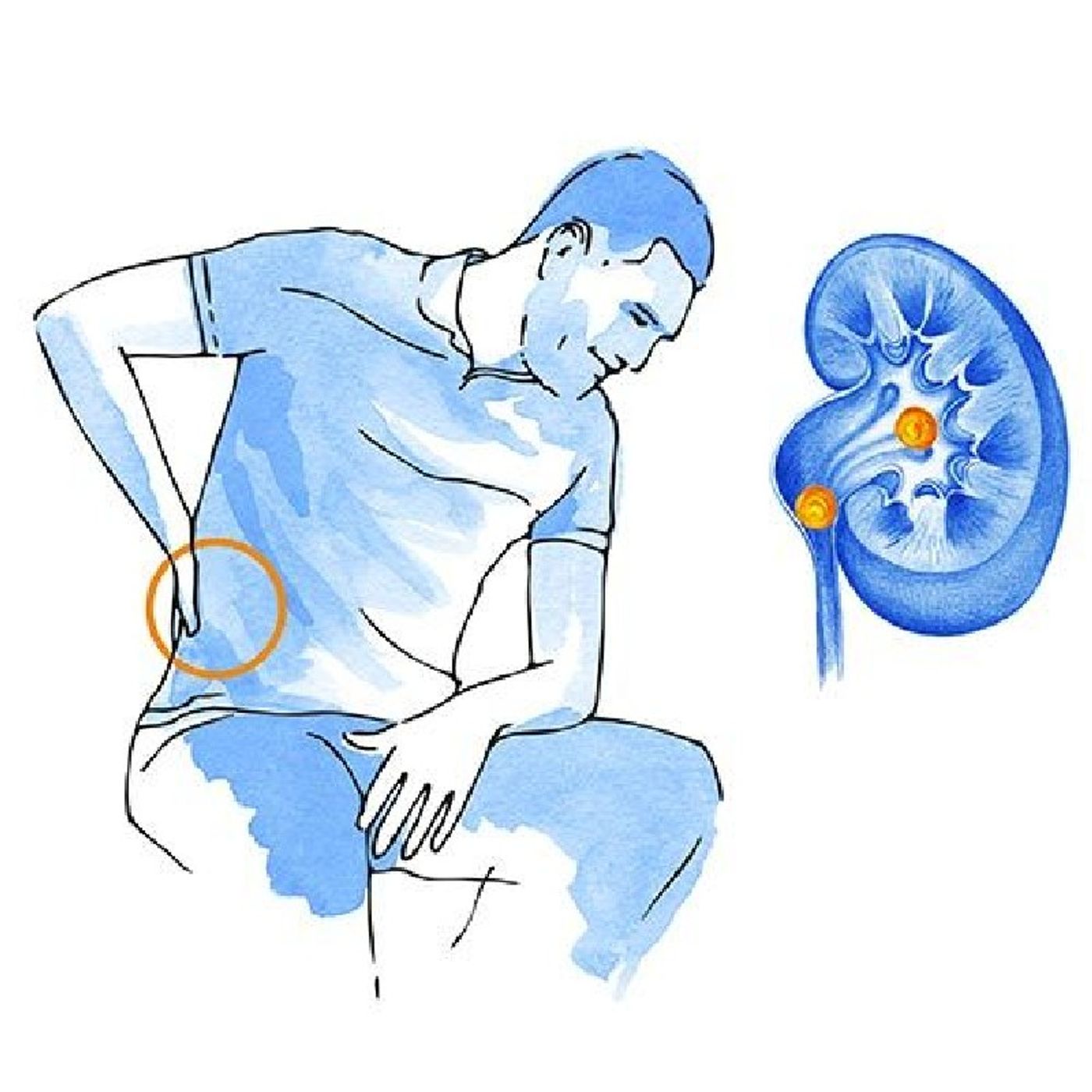 Podcast sobre Cálculo Renal episode artwork