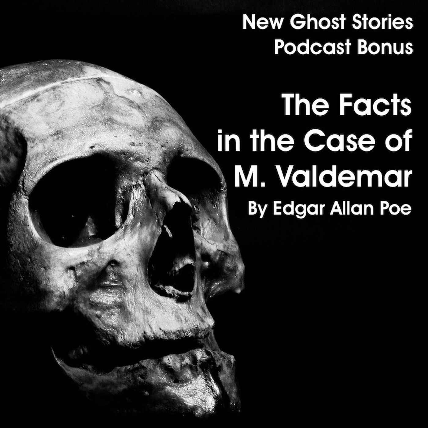 The Facts in the Case of M. Valdemar by Edgar Allan Poe (Bonus 9)