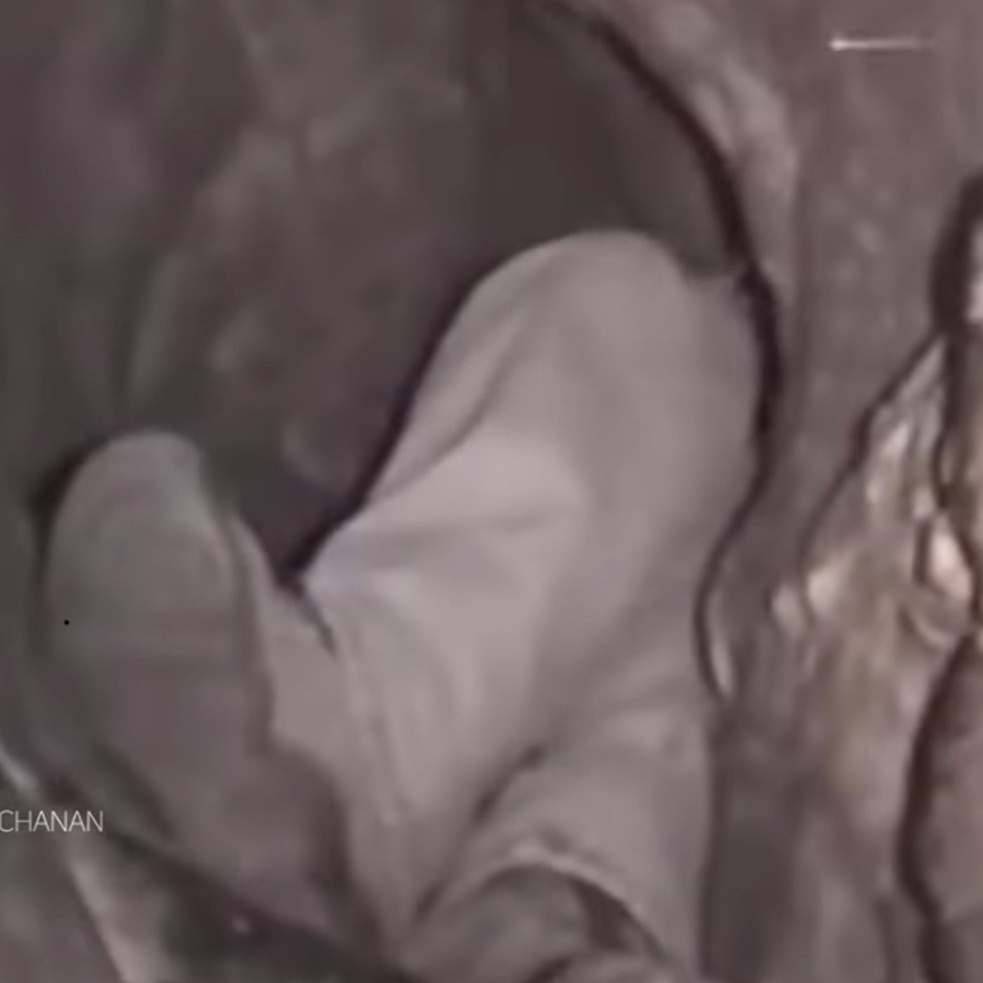 S54E13: Buried Alive: The Tragic Story Of The Brother Who Got Stuck