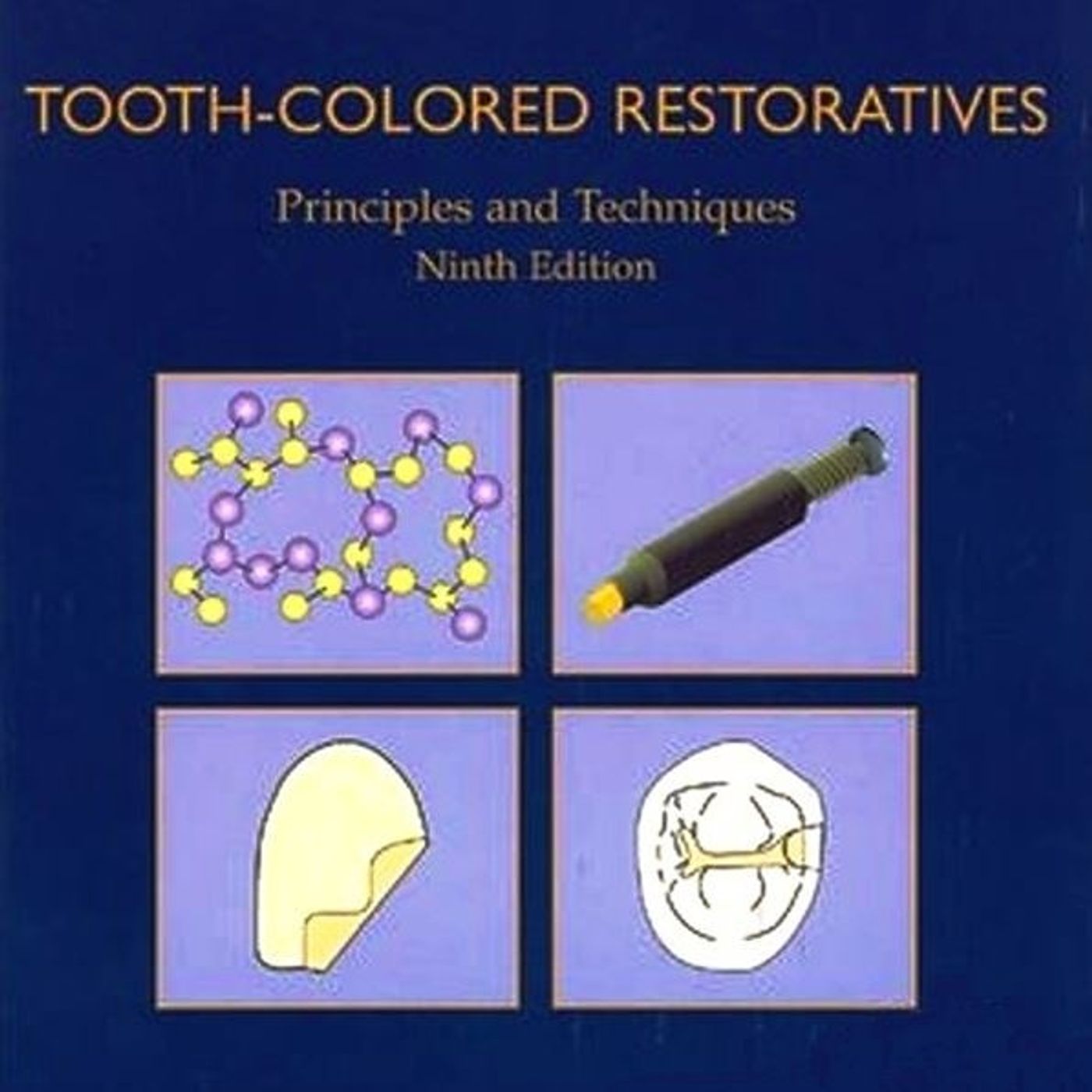 Tooth Colored Restoratives: Principles and Techniques
