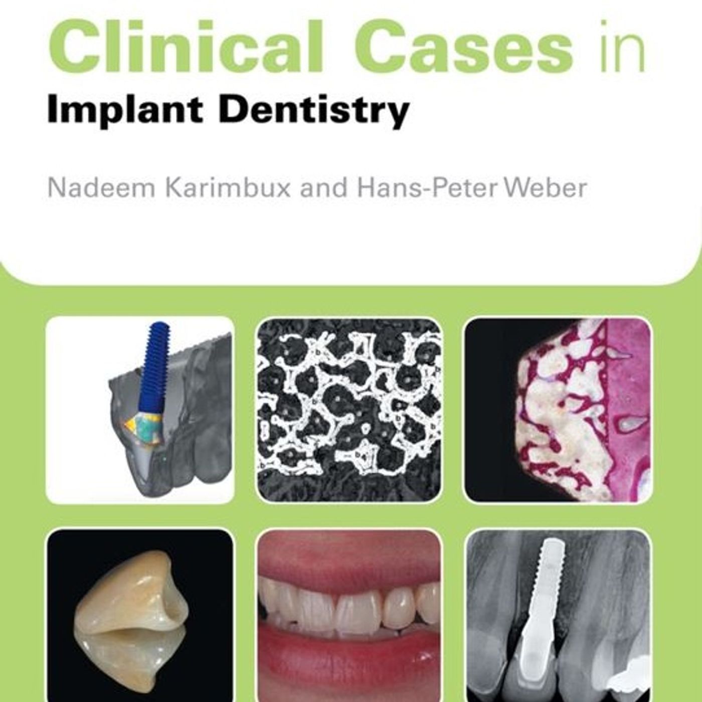 Clinical Cases in Implant Dentistry