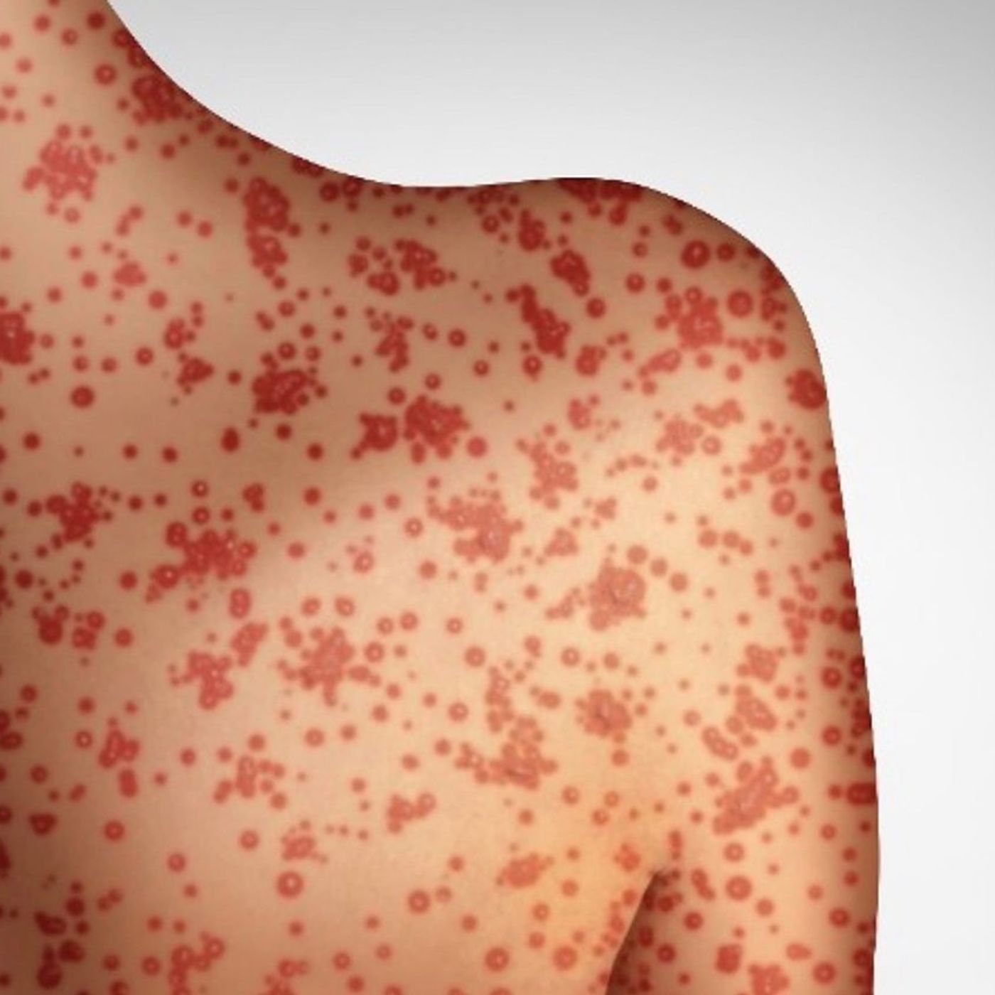 Kane Health Dept. to host Communicable Disease Conference