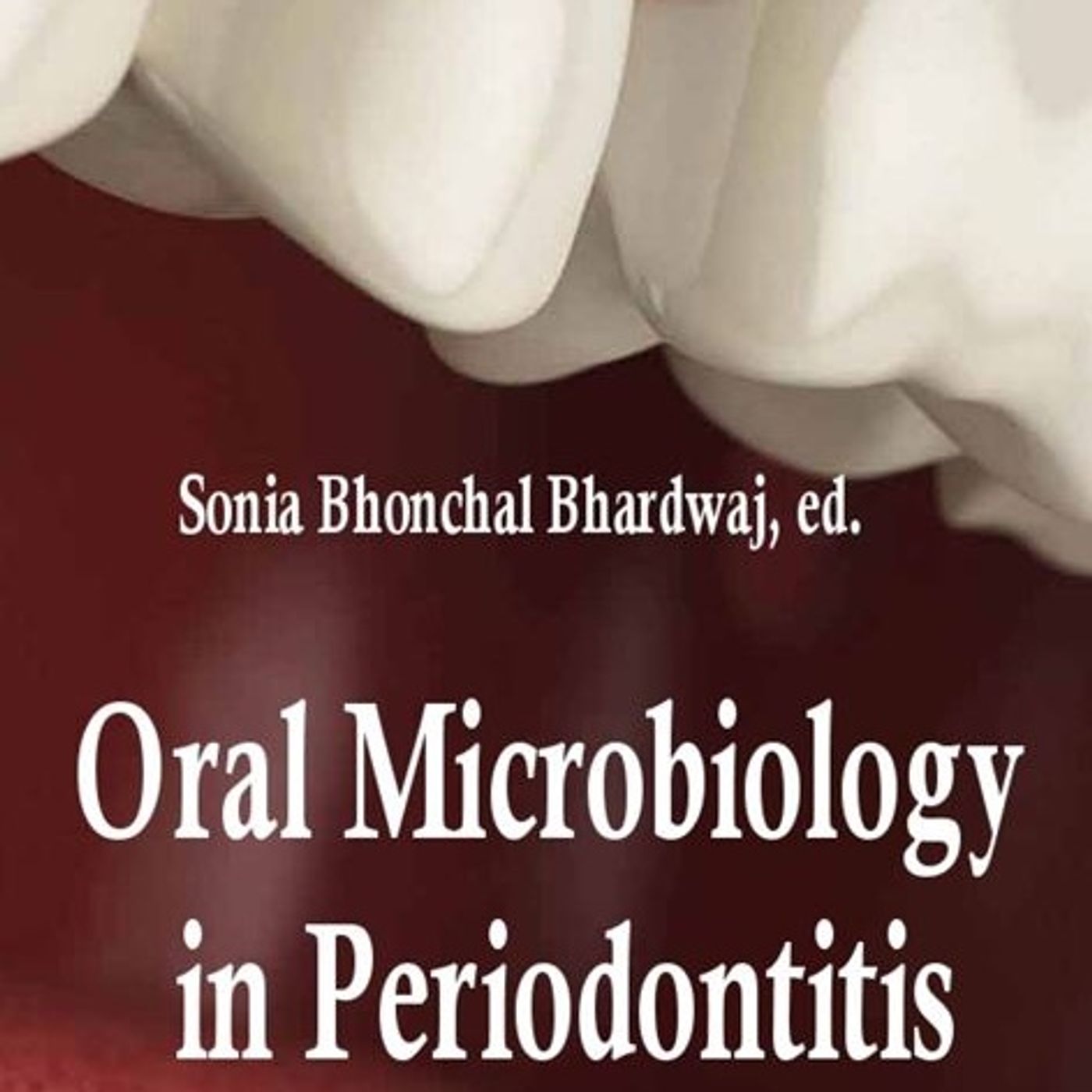 Oral Microbiology in Periodontitis