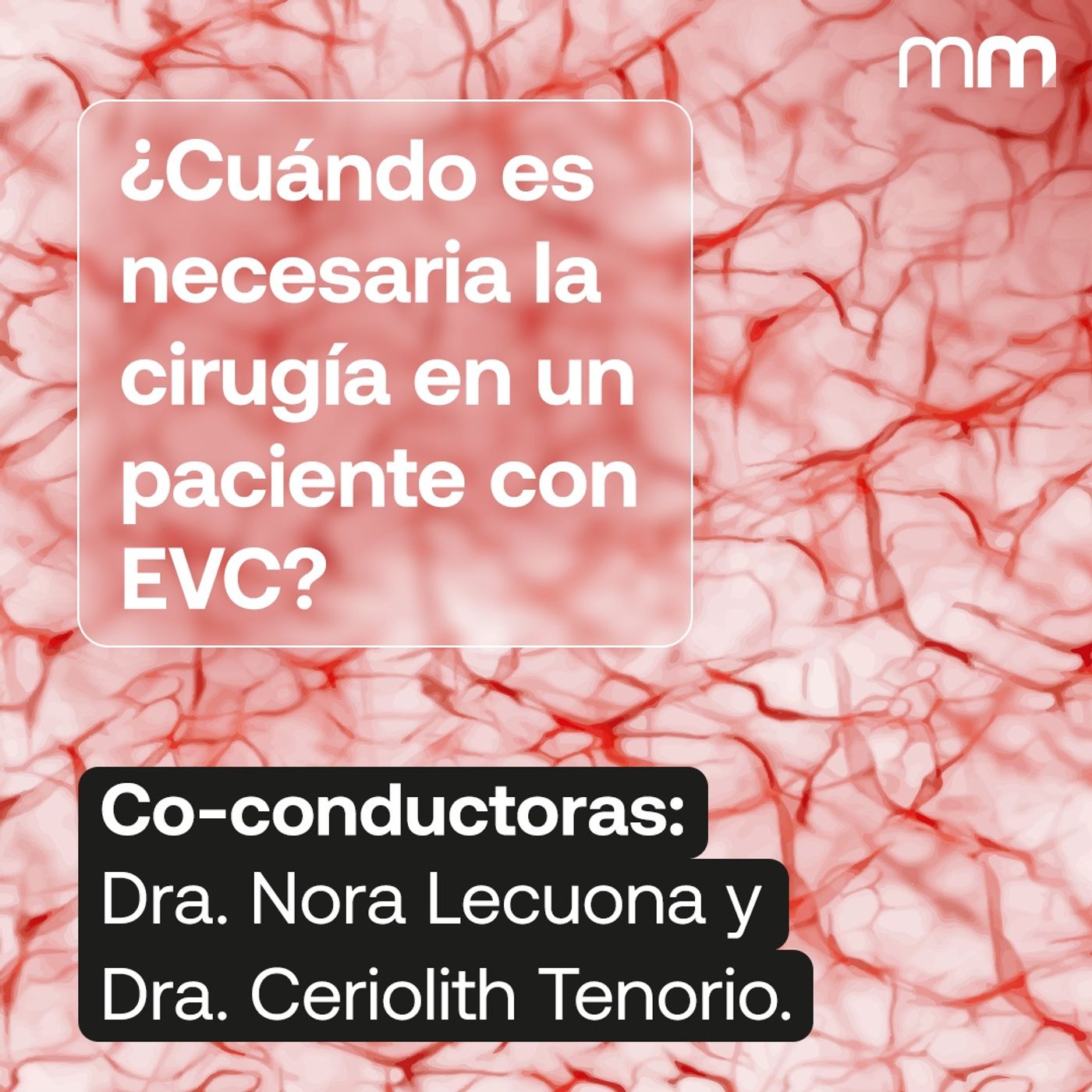 ¿Cuándo es necesaria la cirugía en un paciente con Enfermedad Venosa Crónica?