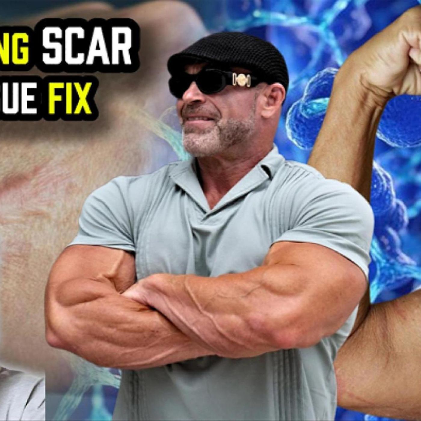 SHOCKING Scar Tissue Fix? My BPC-157 + TB-500 + GHK-Cu Stack (PEPs) SHOCKING Scar Tissue Fix? My BPC-157 + TB-500 + GHK-Cu Stack (PEPs)