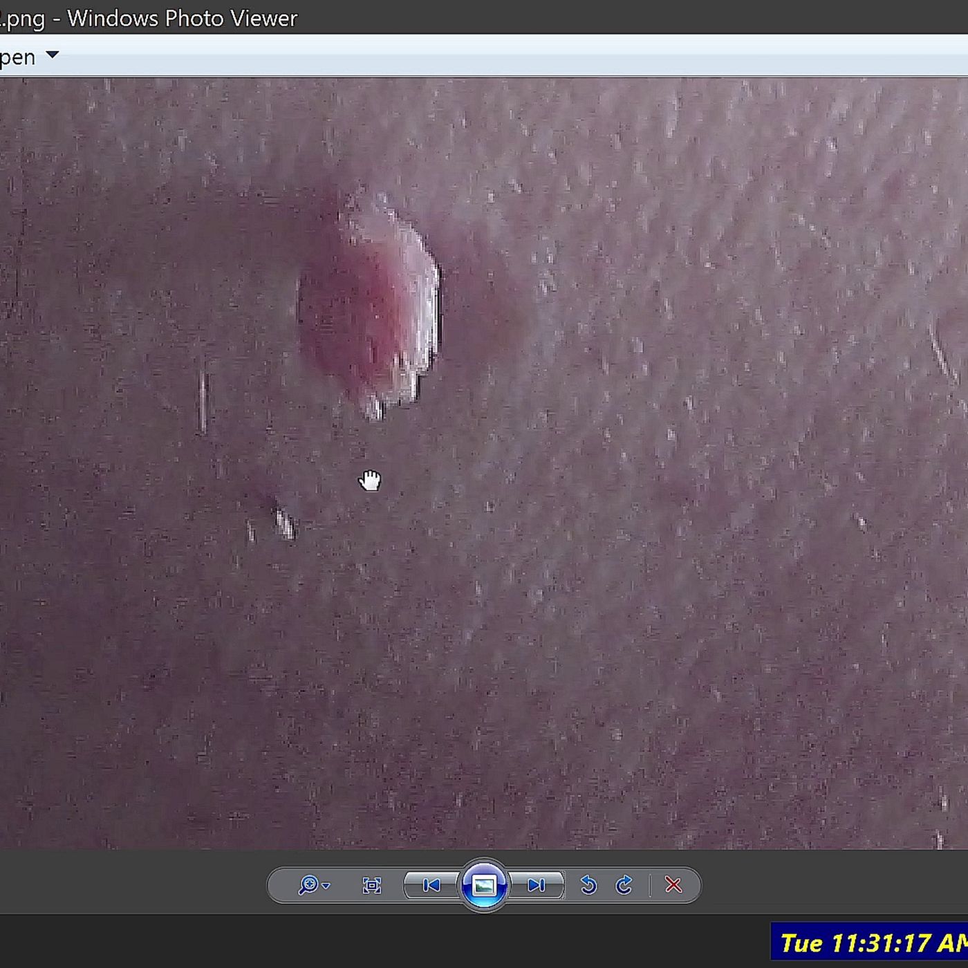 Paul of TOTC,Documenting his on-going Skin Issues,possibly related to Alien Grey/Gray visits Mar2026 episode artwork