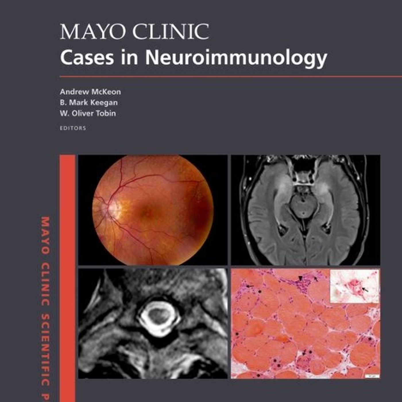 Mayo Clinic Cases in Neuroimmunology