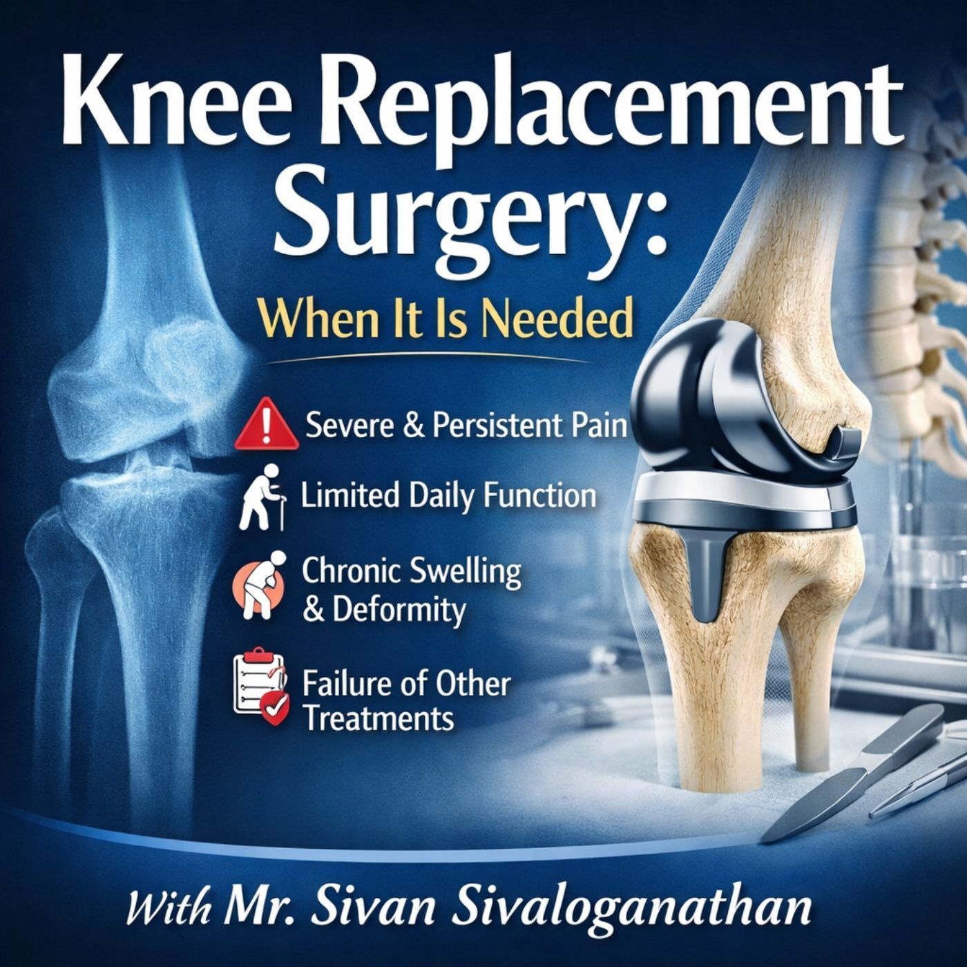 Knee Replacement Surgery: When It Is Nee cover art