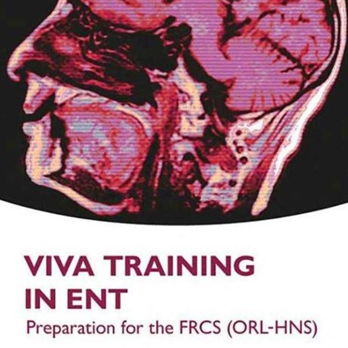 Viva Training in ENT: Preparation for the FRCS (ORL-HNS)