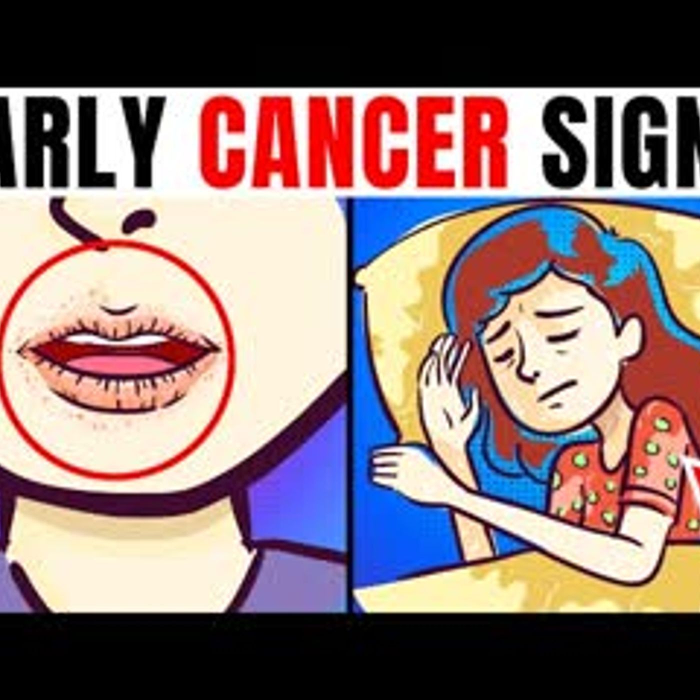 11 Early Cancer Warning Signs That You Shouldn't Ignore episode artwork