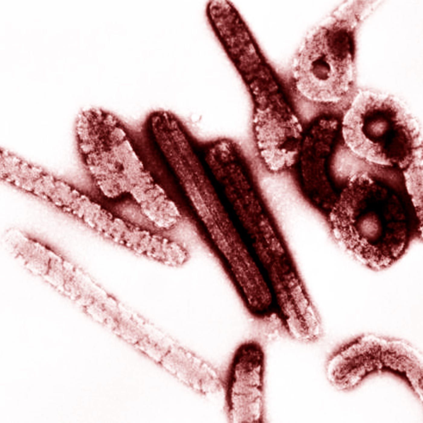 EstíoCast 64 - Virus de Marburg. El brote de 1967 episode artwork