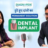 Permanent Solution for Broken Teeth - Dental Implant