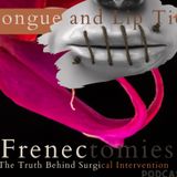 Frenectomies:  The Truth Behind Surgical Intervention