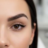 Cejas de “diablo” tras inyecciones con toxina butolínica.  Por qué se produce y cómo se corrigen