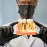 Affordable Dental Implants in Prosper, TX