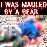 I was mauled by a bear, fought it off, and drove 4 miles down a mountain with my face hanging off.