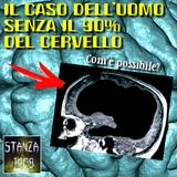 IL CASO DELL'UOMO SENZA IL 90% DEL CERVELLO (Stanza 1408 Podcast)