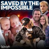 Two Lost Limbs, Two Heartbeats and Second Chances: Miracle Mail | Ep. 89