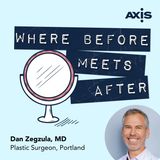 Am I too old for breast reduction surgery? [Dan Zegzula, MD, Portland]