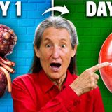 Clean Your Kidneys in 3 Days _ Do This NOW _ Barbara O_Neill