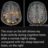 The SLEEP DEPRIVED BRAIN