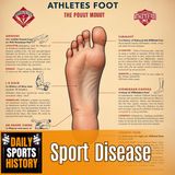 Untold History of Athlete’s Foot: From Ancient Egypt to Modern Sports