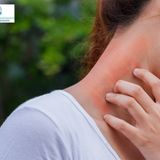 Expert Care for Drug Allergy Rashes at Advanced Dermatology