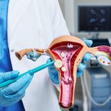 Polipi endometriali: alla San Gaetano Clinica e Ricerca la diagnosi e il trattamento sono in day hospital