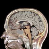 Concussions with Leonard Marshall
