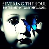Severing the Soul: How the Lobotomy "Cured" Mental Illness.