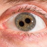 Curiosità rare e caratteristiche pericolose riguardo l'occhio umano