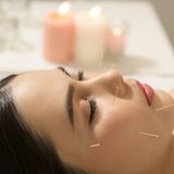 Can acupuncture reduce frown lines? A new clinical study says yes