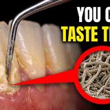 25 Creepy Life Forms Living On Your Body Right Now