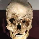 4 | The Cheddar Man