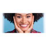 Everything You Need to Know About Teeth Whitening in Kelowna