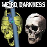 PHINEAS GAGE: A Rod Blasted Through His Head, He Lost Half His Brain, Then He Got Up and Walked Away