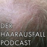 Die zweite Podcast Folge - Chirurgische Haarwiederherstellung