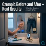Ozempic Before and After — Real Results - The Realistic Timeline: What to Actually Expect