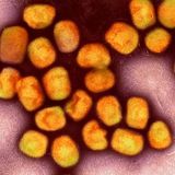 What is Monkeypox? With Dr. Anne Rimoin