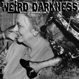 Spontaneous Human Combustion | They Found Only Her Skull and Foot; Her Room Left Unscorched