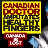 Canada Is Lost, Dr Amputates Man's Healthy Fingers For Body Integrity Dysmorphia