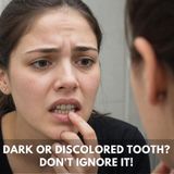 Why Is My Tooth Turning Dark All of a Sudden