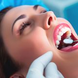 Teeth Filling Services by Clarity Dental