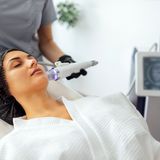 Microneedling_and_PRX_Derm_for_Skin_Repair