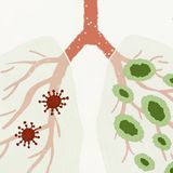 Beyond "Rest and Fluids": Natural Treatments For Respiratory Infections