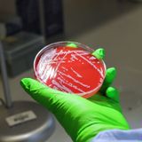 Bacterial survival genes uncovered using evolutionary map
