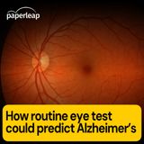 How routine eye test could predict Alzheimer’s