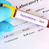 Testosterone Test: Assess Your Hormone Health