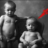 The Stillborn Twins _ Photographed in Death_ Eyes Wide Open (1865)