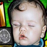 This Child Had 23 Of Worst Brain Injuries Ever